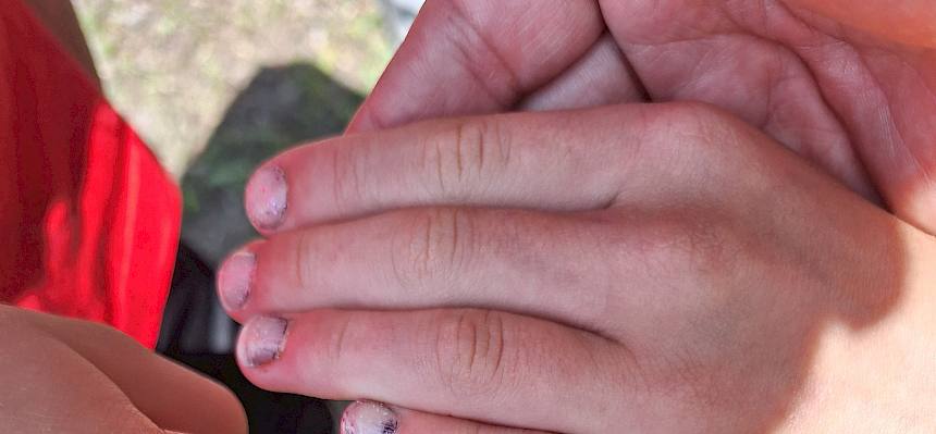 Schwebfliege auf Finger